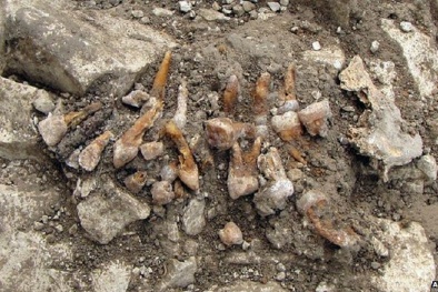 Chiếc răng giả sớm nhất ở Tây Âu được phát hiện